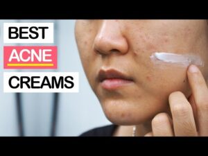 tube creams that treat acne